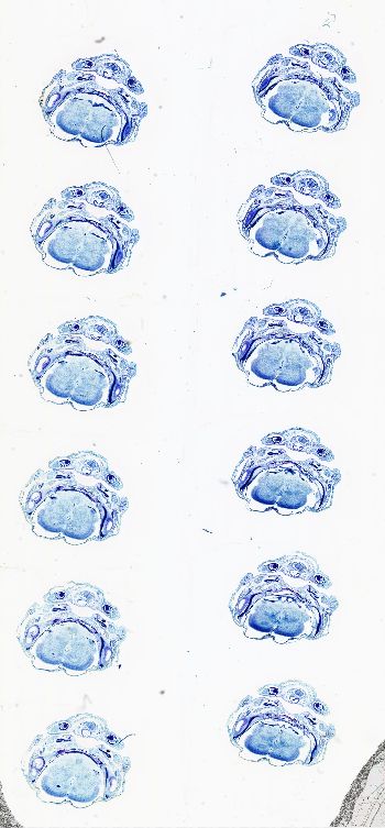 Media type: image; Special Collections 3102   shows specimen_part histological serial section;  Description: Whole slide scan, SC-3102, slide 16;